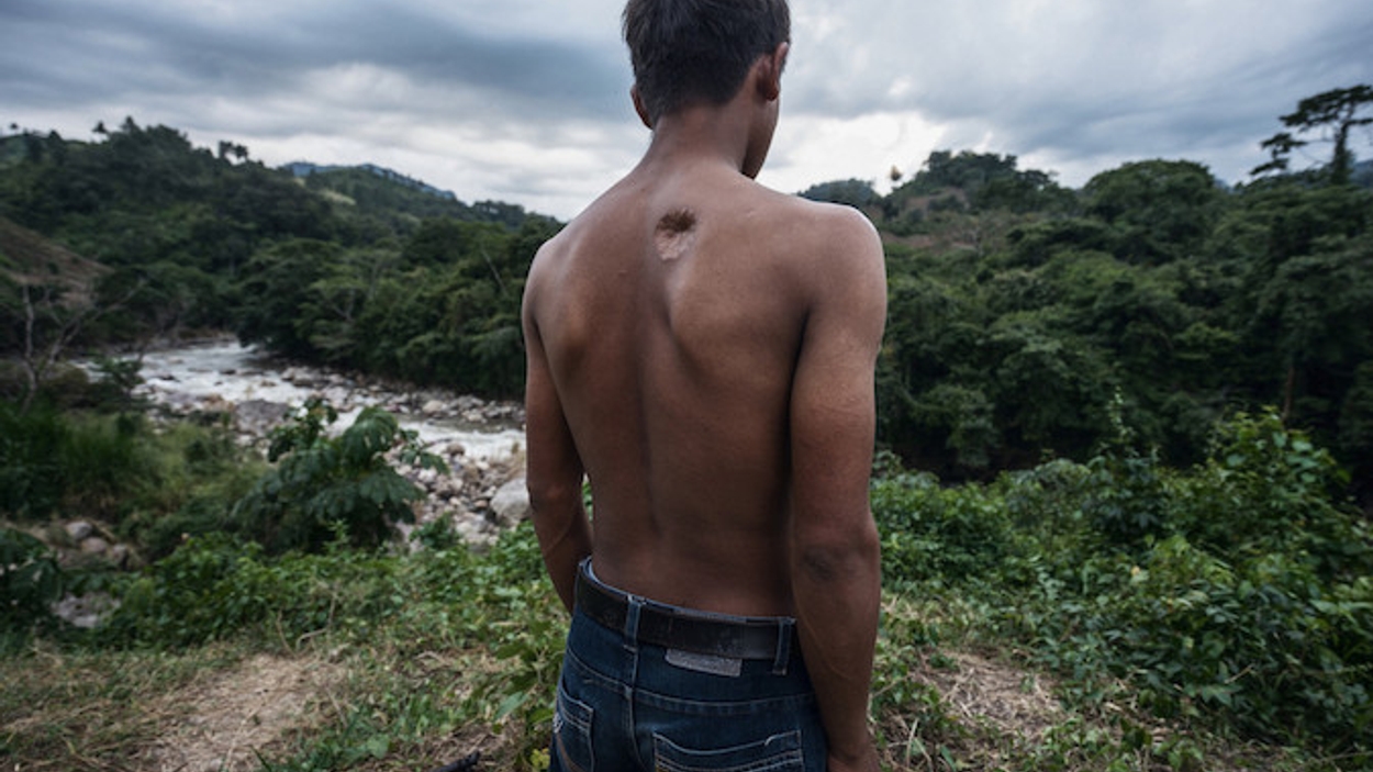Alan García werd van dichtbij neergeschoten door Hondurese militaire tijdens een demonstratie tegen de Agua Zarca dam. Bron: Global Witness