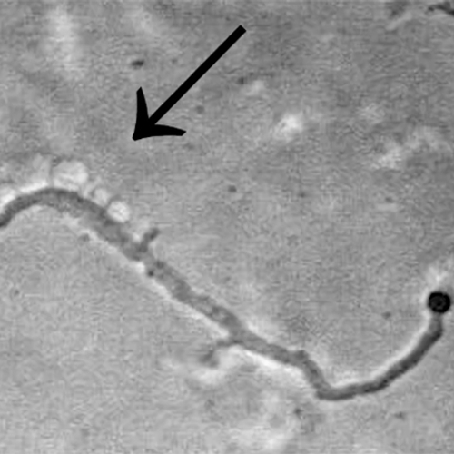 Afbeelding van Ontdekking: Bacterie onder stress verliest celwand